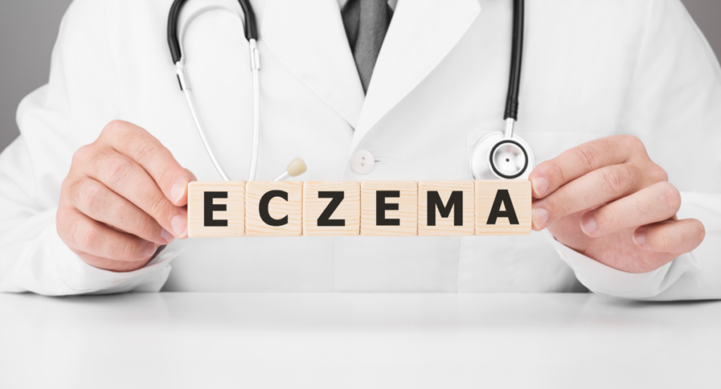 Filtered water helps with eczema