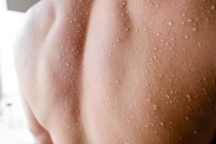Person's wet back after showering